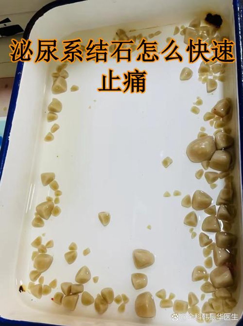 前列腺炎治疗新趋势：让男性健康不再受困