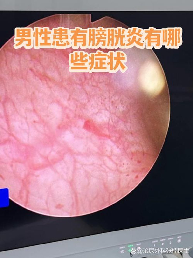 西宁泌尿专科医院：守护男性健康的重要堡垒
