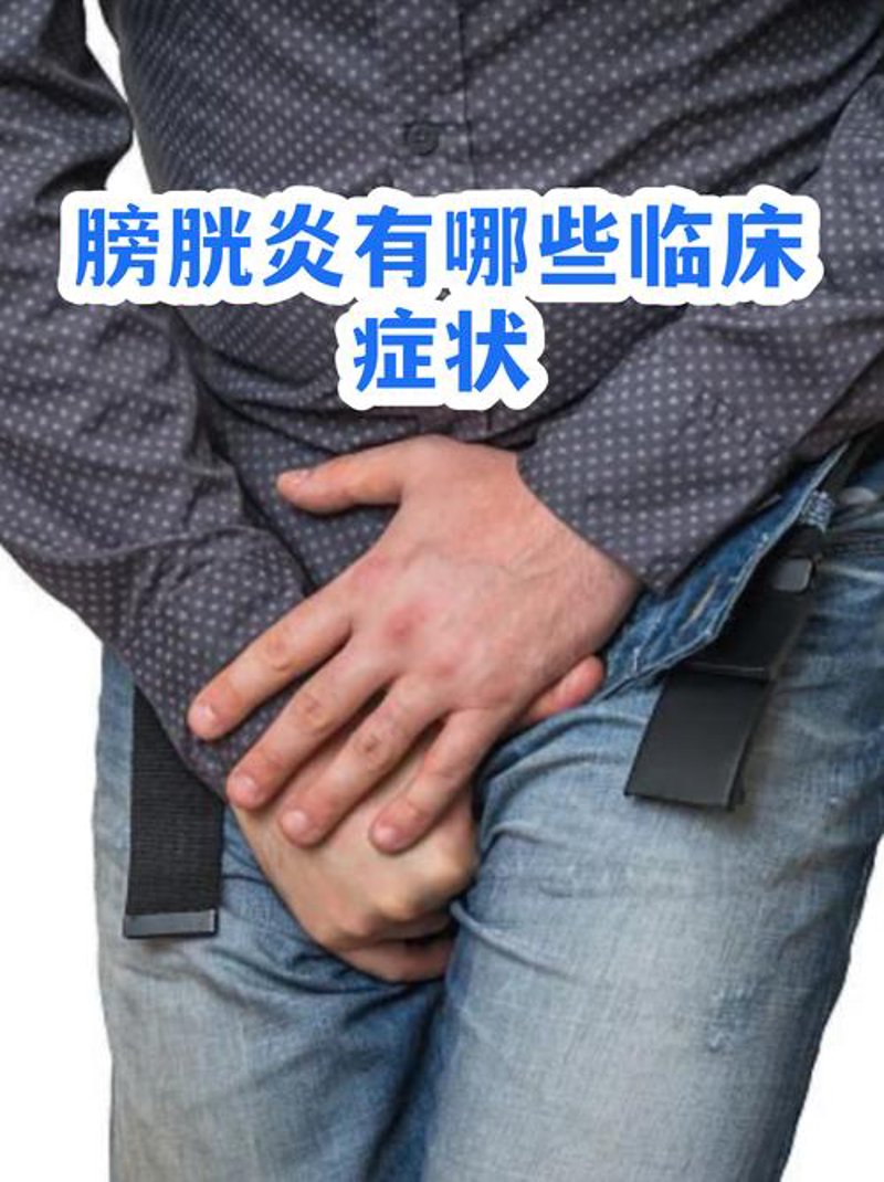 膀胱炎：女性健康的小杀手