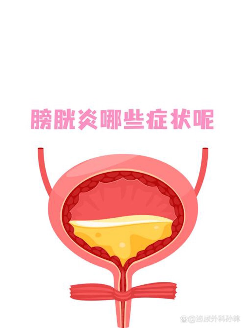 膀胱炎案例分析：小希的健康历险记